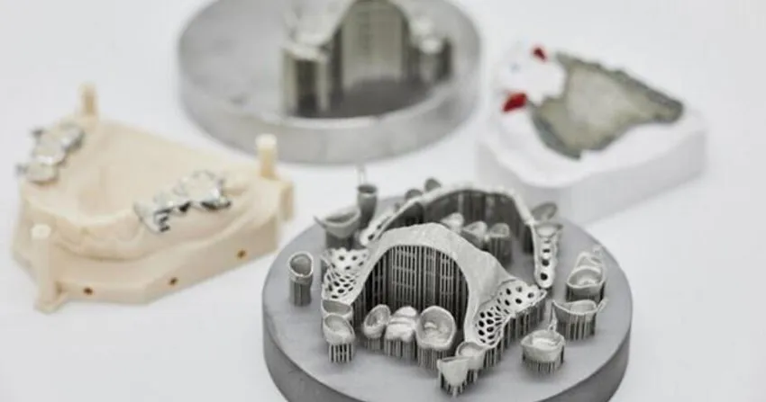 3d printed dental implants